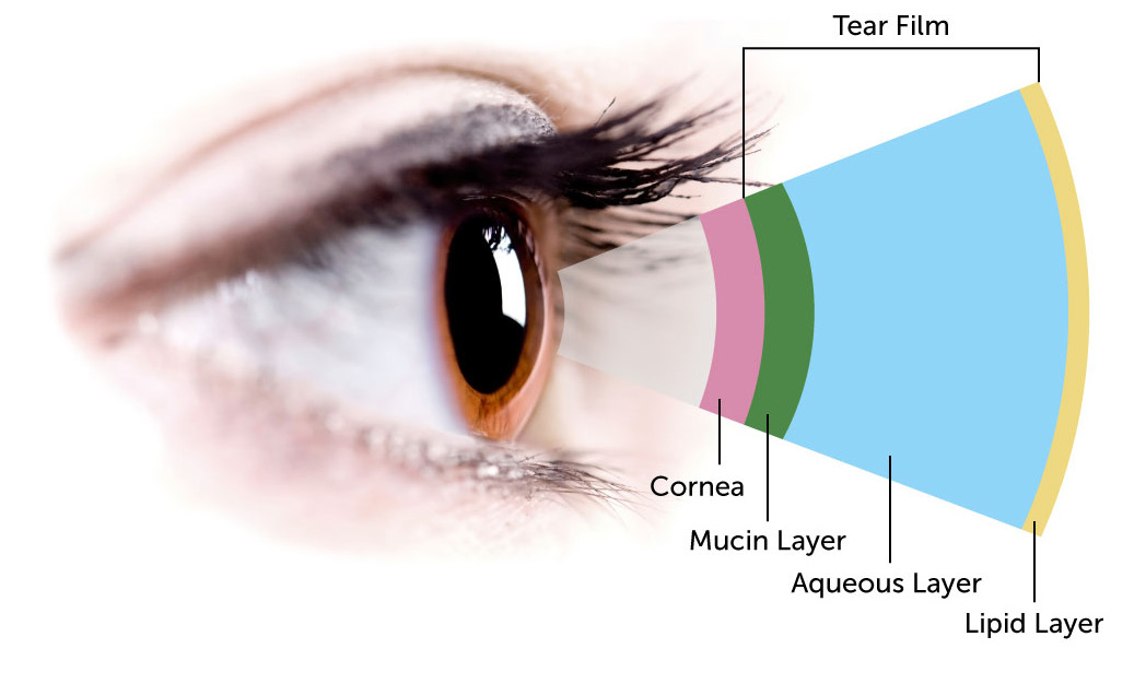 What You Need to Know About Dry Eye - Black Hills Eyes